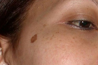 0001-1of2