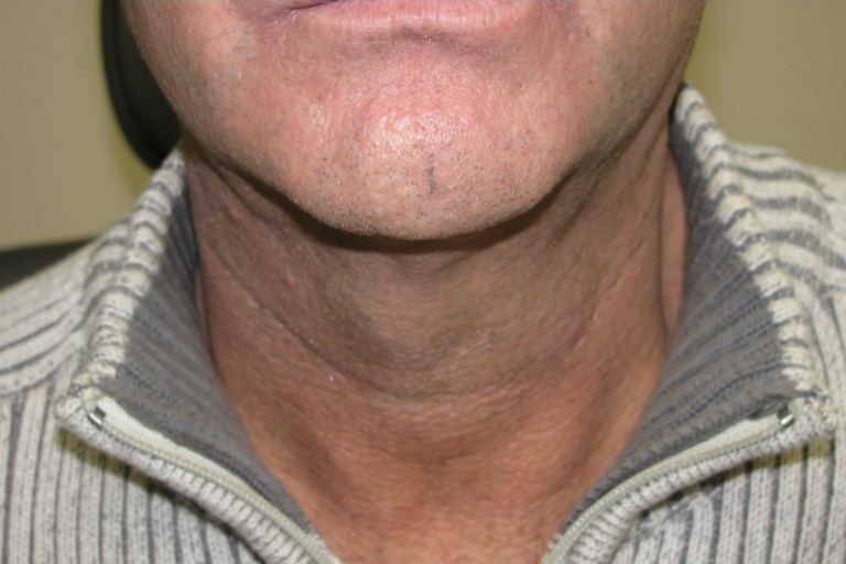 3538-21034