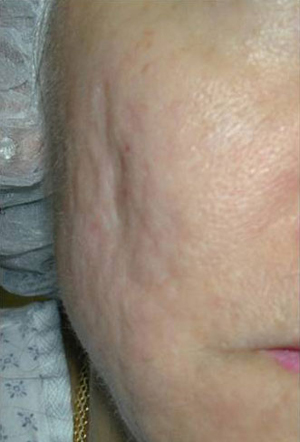 2011-5of6