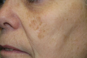 1002_4of4