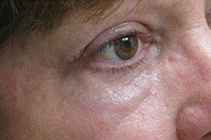 1007_4of6