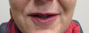 98981-2of2