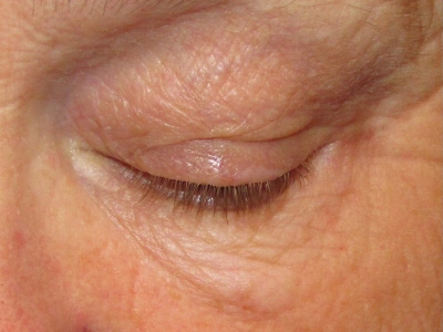 3999-2of2