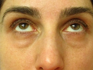 6536-11779