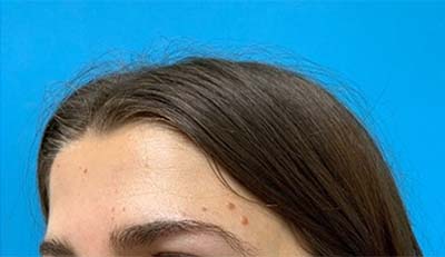 6998-99528