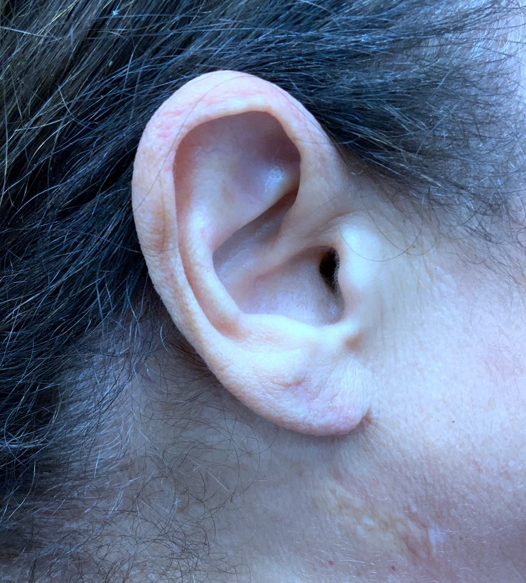image1 (2)