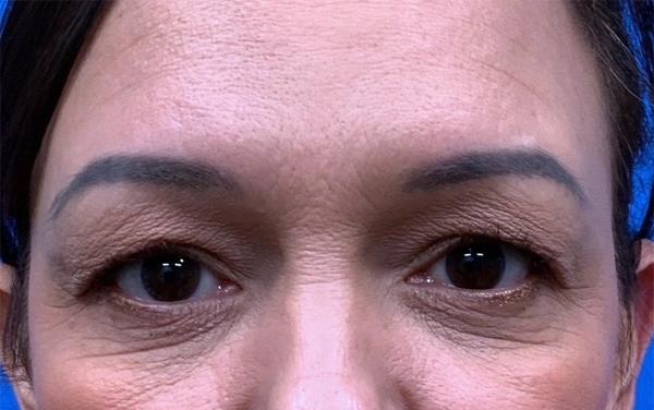 image2.webp